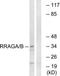 Ras Related GTP Binding A antibody, TA315091, Origene, Western Blot image 