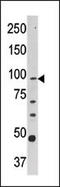 Carnitine Palmitoyltransferase 1A antibody, 61-413, ProSci, Western Blot image 