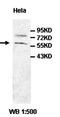 Uncharacterized aarF domain-containing protein kinase 4 antibody, orb77752, Biorbyt, Western Blot image 