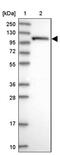 2'-5'-Oligoadenylate Synthetase 3 antibody, PA5-59539, Invitrogen Antibodies, Western Blot image 