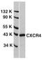 DEAD-Box Helicase 10 antibody, NBP1-21322, Novus Biologicals, Western Blot image 