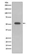 Keratin 10 antibody, M02305-1, Boster Biological Technology, Western Blot image 