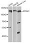 Neurotrophic Receptor Tyrosine Kinase 3 antibody, A14033, ABclonal Technology, Western Blot image 