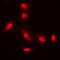 Akt antibody, LS-C351800, Lifespan Biosciences, Immunofluorescence image 