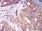 Killer cell immunoglobulin-like receptor 3DL1 antibody, NBP2-61687, Novus Biologicals, Immunohistochemistry paraffin image 