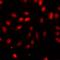 N-Terminal Xaa-Pro-Lys N-Methyltransferase 1 antibody, LS-C668526, Lifespan Biosciences, Immunofluorescence image 