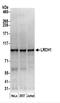 Leucine Rich Repeats And Calponin Homology Domain Containing 1 antibody, NBP2-44281, Novus Biologicals, Western Blot image 