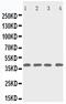 Ribonucleoside-diphosphate reductase subunit M2 B antibody, PA5-79938, Invitrogen Antibodies, Western Blot image 