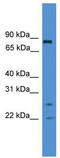 A-Kinase Anchoring Protein 8 Like antibody, TA330606, Origene, Western Blot image 
