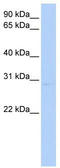 Potassium Voltage-Gated Channel Interacting Protein 2 antibody, TA338766, Origene, Western Blot image 