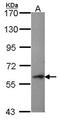 Perforin 1 antibody, orb73857, Biorbyt, Western Blot image 