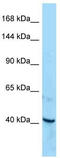 Receptor Tyrosine Kinase Like Orphan Receptor 1 antibody, TA343347, Origene, Western Blot image 