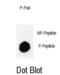 Lysine-specific demethylase 4B antibody, abx032109, Abbexa, Dot Blot image 