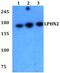 Latrophilin-1 antibody, PA5-75811, Invitrogen Antibodies, Western Blot image 