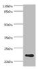 Recoverin antibody, A57281-100, Epigentek, Western Blot image 