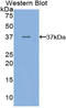 Fms Related Tyrosine Kinase 4 antibody, LS-C296968, Lifespan Biosciences, Western Blot image 