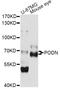 Podocan antibody, LS-C749316, Lifespan Biosciences, Western Blot image 