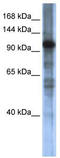 hARP antibody, TA335634, Origene, Western Blot image 