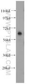 Frizzled Class Receptor 9 antibody, 13865-1-AP, Proteintech Group, Western Blot image 