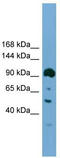 DEAD-Box Helicase 20 antibody, TA342325, Origene, Western Blot image 