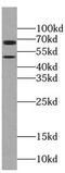 Pantothenate kinase 2, mitochondrial antibody, FNab06134, FineTest, Western Blot image 