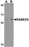 RAB Guanine Nucleotide Exchange Factor 1 antibody, NBP1-76548, Novus Biologicals, Western Blot image 