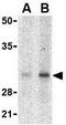 Snail Family Transcriptional Repressor 2 antibody, GTX31748, GeneTex, Western Blot image 