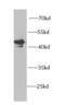 Phosphorylase Kinase Catalytic Subunit Gamma 2 antibody, FNab06395, FineTest, Western Blot image 