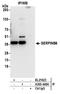 Serpin Family B Member 6 antibody, A305-448A, Bethyl Labs, Immunoprecipitation image 