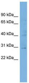 Spermatogenesis Associated 46 antibody, TA346495, Origene, Western Blot image 