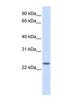 Nucleophosmin/Nucleoplasmin 2 antibody, NBP1-58109, Novus Biologicals, Western Blot image 