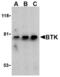Bruton Tyrosine Kinase antibody, LS-C455, Lifespan Biosciences, Western Blot image 