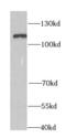 Probable ATP-dependent RNA helicase DDX58 antibody, FNab02317, FineTest, Western Blot image 