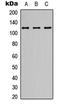 Glutamate Ionotropic Receptor NMDA Type Subunit 1 antibody, abx121534, Abbexa, Western Blot image 