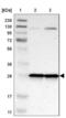 Mitochondrial Ribosomal Protein L9 antibody, NBP1-89561, Novus Biologicals, Western Blot image 