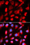 Uroporphyrinogen decarboxylase antibody, 19-699, ProSci, Immunofluorescence image 