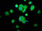 Coproporphyrinogen Oxidase antibody, LS-C674957, Lifespan Biosciences, Immunofluorescence image 