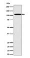 Nucleoporin 107 antibody, M03724, Boster Biological Technology, Western Blot image 