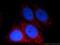 HPS4 Biogenesis Of Lysosomal Organelles Complex 3 Subunit 2 antibody, 14627-1-AP, Proteintech Group, Immunofluorescence image 