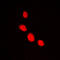 LIM Homeobox 1 antibody, LS-C352449, Lifespan Biosciences, Immunofluorescence image 