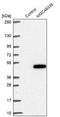 Zinc Finger Protein 843 antibody, NBP1-93468, Novus Biologicals, Western Blot image 
