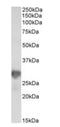 Nicotinamide N-Methyltransferase antibody, orb198496, Biorbyt, Western Blot image 