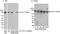 DNA topoisomerase 2-alpha antibody, A300-054A, Bethyl Labs, Western Blot image 