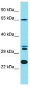 Kinesin Light Chain 4 antibody, TA337394, Origene, Western Blot image 
