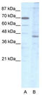 LIM/homeobox protein Lhx2 antibody, TA330113, Origene, Western Blot image 