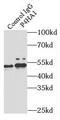Prolyl 4-hydroxylase subunit alpha-1 antibody, FNab06078, FineTest, Immunoprecipitation image 