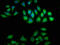 Crystallin Beta A1 antibody, CSB-PA006009LA01HU, Cusabio, Immunofluorescence image 
