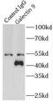 Galectin 9 antibody, FNab03313, FineTest, Immunoprecipitation image 