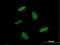 Zinc Finger Protein 557 antibody, H00079230-B01P, Novus Biologicals, Immunocytochemistry image 