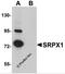 Sushi Repeat Containing Protein X-Linked antibody, 5473, ProSci, Western Blot image 